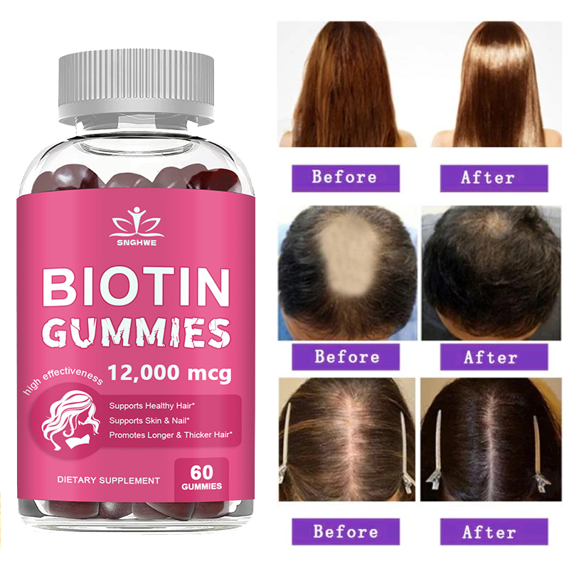 Hair Care Gummies - Kollajen Gummies cilt bakımı için Biotin
