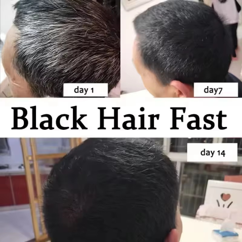 Gri Beyaz Saç Bakım Serumu Bey - Hair Care Ginseng incelemesi ve fiyatı