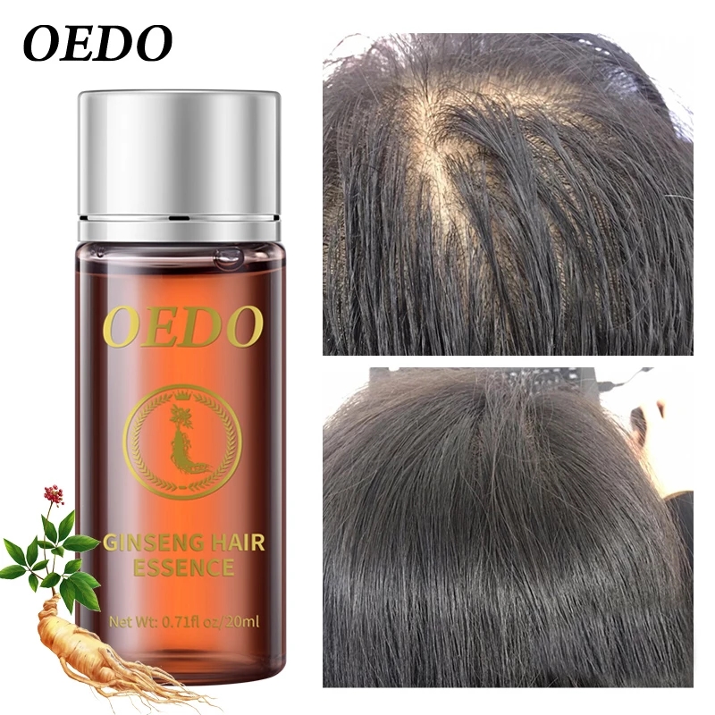 20ML Ginseng Saç Büyüme Özü Sa - Hair Care Ginseng incelemesi ve fiyatı