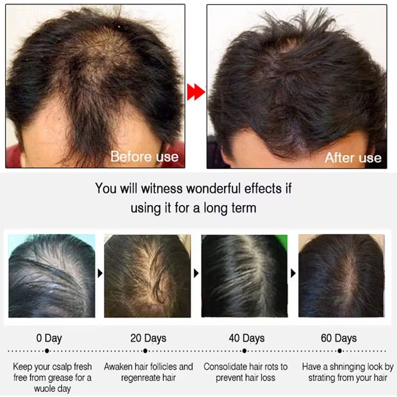 Hızlı Zencefilli Saç Uzatma Sp - Hair Care Natur incelemesi ve fiyatı